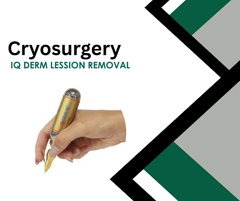 Cryosurgery Training