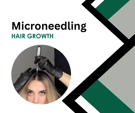 Hair Growth  Microneedling | 1 Day