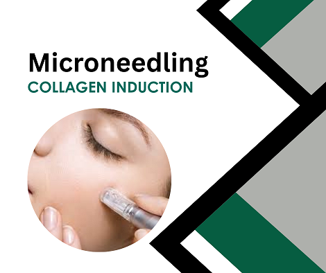 Microneedle CIT | 1 Day Training