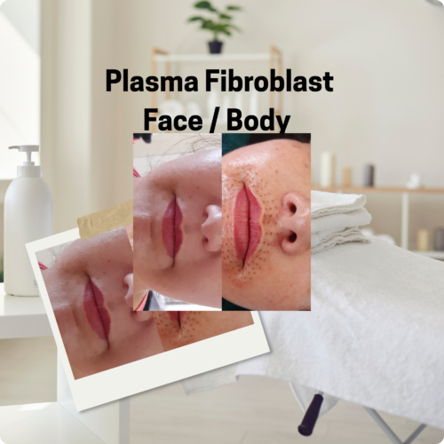 Plasma Fibroblast Treatments