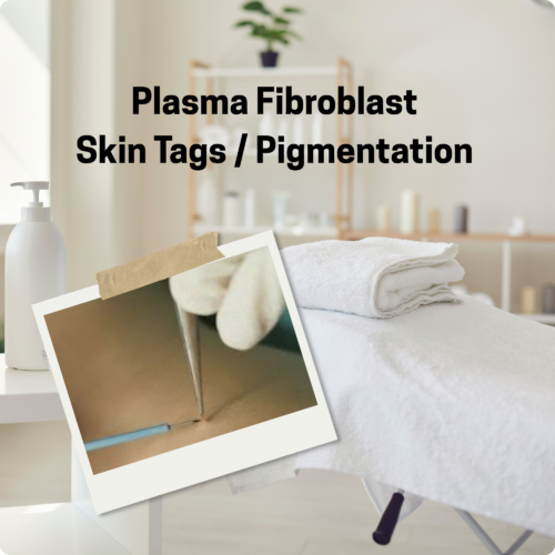Skin Tag and Spot removal